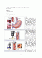 [성인간호학][토혈][hematemesis] 케이스 스터디(Case Study), 문헌고찰 8페이지