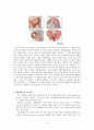 [여성간호학][C/SEC][제왕절개] 케이스 스터디(Case Study), 문헌고찰[cesarean section] 3페이지