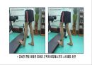 아킬레스 건염 재활 운동 (Achilles Tendinitis 정의, 원인, 진단, 분류, Paratenonitis(건주위염)치료, Tendinosis(퇴행성 건염) 치료, Achilles Tendon Rupture 정의, 증상, 아킬레스건 수술, 재활 운동).PPT자료 44페이지