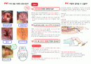 [지역사회간호학] 보건소 HPV 자궁경부암 팜플렛 1페이지