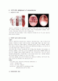 (A+) 비인두암 케이스 스터디 Malignant neoplasm of nasopharynx case study 1페이지