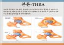 THRA PPT Anatomy 와 관련질환 수술방법  15페이지