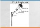 THRA PPT Anatomy 와 관련질환 수술방법  18페이지