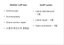 회선근개 재활 운동 (어깨 수술의 이해 Shoulder operation, 어깨 재활 운동 0~2주 재활운동, ROM Exercise, 스트레칭 Stretching, Simple EX 10분).PPT자료 4페이지