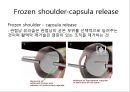 회선근개 재활 운동 (어깨 수술의 이해 Shoulder operation, 어깨 재활 운동 0~2주 재활운동, ROM Exercise, 스트레칭 Stretching, Simple EX 10분).PPT자료 12페이지