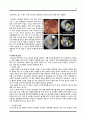 [성인간호학 case] 위암 대상자 간호과정 케이스 case study - 위암 (Gastric Cancer) 5페이지