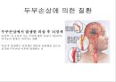 뇌종양종류 및 증상,양성종양 VS 악성종양,뇌종양 수술 방법,뇌종양에 좋은 음식,뇌농양,두부손상,두부손상 응급처치,두부손상에 의한 질환 20페이지