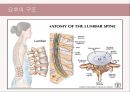 (스포츠의학, 운동처방관련학과) Spondylolisthesis 척추전방전위증 -정의 원인 증상 및 운동방법 3페이지