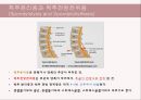 (스포츠의학, 운동처방관련학과) Spondylolisthesis 척추전방전위증 -정의 원인 증상 및 운동방법 5페이지