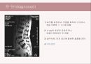 (스포츠의학, 운동처방관련학과) Spondylolisthesis 척추전방전위증 -정의 원인 증상 및 운동방법 14페이지