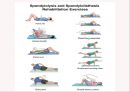 (스포츠의학, 운동처방관련학과) Spondylolisthesis 척추전방전위증 -정의 원인 증상 및 운동방법 21페이지