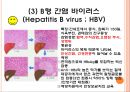 [(미생물학 A+ 발표자료)] 의학적으로 중요한 바이러스 (바이러스의 구조와 분류, 바이러스의 증식, 진행과정, 외피비보유 DNA 바이러스, 외피보유 DNA 바이러스).pptx 19페이지