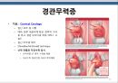 [모성간호학]임신중 출혈성 합병증- 임신 전반기 출혈성 합병증 및 임신 후반기 출혈성 합병증 12페이지