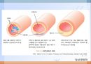 심혈관계 질환(임상영양학, 심장의구조, 고혈압, 이상지혈증, 동맥경화증, 심장질환, 뇌졸증) PPT, 파워포인트 47페이지