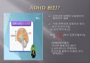 ADHD오해와 진실,Adhd는 주의력 결핍 과잉행동장애,ADHD는 과잉 진단,집중력 장애 ppt 5페이지