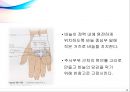 정맥주사요법 (부위,과정,부작용,영상) 14페이지