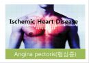 협심증(angina pectoris)간호과정 PPT 1페이지