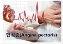 협심증(angina pectoris)간호과정 PPT 5페이지