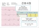 협심증(angina pectoris)간호과정 PPT 20페이지