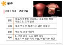 여성실습 난소낭종 케이스 7페이지