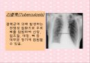 노화와 관련된 호흡기계변화(천식, COPD, 만성기관지염, 폐기종, 폐렴, 질환에 따른 간호) 30페이지