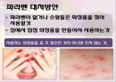 「화장품 부작용」 관련 자료 (화장품 부작용이란?, 화장품 부작용 종류, 부작용을 일으키는 성분들, 부작용 예방법과 해결책).pptx 26페이지