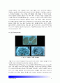 [2015기초간호과학] 면역에 관여하는 세포, 면역관련 4가지형태 과민반응 특징, 주요질환, 4가지 면역 과민반응별 질환 발생기전, 종양의 병기, 악성종양 TNM분류방법, 종양이 인체에 미치는 국소영향 전신영향 4페이지