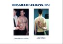 01. 어깨근육 (shoulder muscle)의 기시, 정지 , 작용 , TP사진, 기능적 단위 등.pptx 22페이지