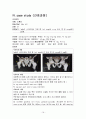 정형외과 골반질환손상 골반구조 간호과정 케이스 스터디 Case Study - 진단명: acetabulum Fx(비구골절) 주호소: Rt leg tingling sense, Rt leg pain 19페이지