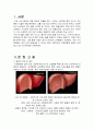 간경변증(LC : liver cirrhosis) 대상자에 대한 사례연구, 케이스 스터디 CASE STUDY - 진단명 : Liver cirrhosis, TB meningocehalitis, ginrival bleeding 2페이지