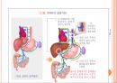식도정맥류결찰술(食道靜脈瘤結紮術 EVL)의 적응증과 치료.pptx 7페이지