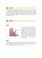 Case Study Intussusception 아동간호학 케이스스터디 장중첩증 (A+자료) 3페이지