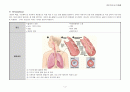 크룹증후군(croup syndromes) 4페이지