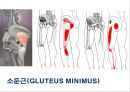 03. 골반 근육 (pelvic muscle)의 기시, 정지 , 작용 , TP사진, 기능적 단위 등.pptx 25페이지