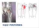 03. 골반 근육 (pelvic muscle)의 기시, 정지 , 작용 , TP사진, 기능적 단위 등.pptx 27페이지