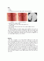 뇌내출혈(ICH) Case Study - 문헌고찰, 간호과정(진단3개) 3페이지