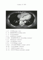 Cardiac CT 3페이지