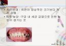 [치주질환 (periodontal disease)] 치주질환 정의, 치주질환 종류, 치주질환 원인, 치주질환 증상, 치주질환 치료.ppt 20페이지