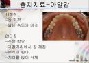 [치주질환 (periodontal disease)] 치주질환 정의, 치주질환 종류, 치주질환 원인, 치주질환 증상, 치주질환 치료.ppt 26페이지