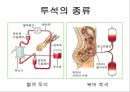 비뇨생식기계 질환 2 - 신부전(Renal Failure).ppt 41페이지