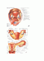 cesarean section 제왕절개술 - 정리, 정의, 구조, 기능, 종류, 수술 5페이지