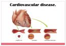 비타민D와 성인질환 (Vitamin D Deficiency & Risk of Cardiovascular Disease).pptx 13페이지