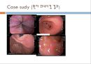 UGI bleeding.pptx 55페이지