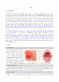 편도선염 케이스 - 간호진단 5개, 간호과정 3개 3페이지