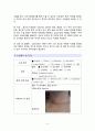 수술실 케이스 스터디 - Lobectomy of thyroid, 갑상선 절제술 4페이지