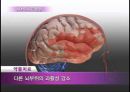 청소년의 정신건강문제(불안증, ADHD, 틱장애, 외상후스트레스장애, 인터넷중독, 스마트폰중독, 청소년우울증) PPT, 파워포인트 3페이지