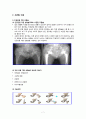 ★ 성인간호학 ( CASE STUDY ) -  대퇴 경부 골절 ( 대퇴 경부 골절, 고관절 수술, 대상자 자료수집, 치료, 간호과정 ) 7페이지