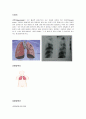 폐결핵 case study [ 성인간호학 실습 폐결핵 컨퍼런스 자료 - 문헌고찰, 약물, 진단검사, 과거력, 간호과정 완벽자료 ] 2페이지