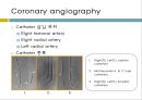 coronory angiography 9페이지