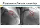 coronory angiography 10페이지